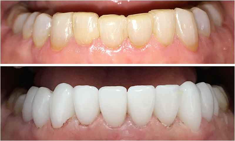 cosmetic dentistry calahonda